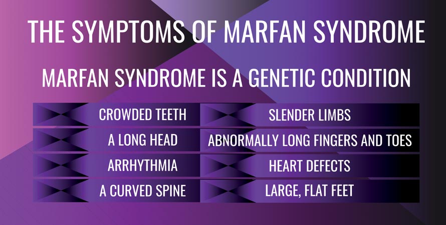Marfan Syndrome: Top 10 Famous People with Marfan Syndrome